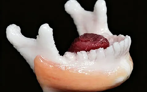 3d printer dental application deweimed